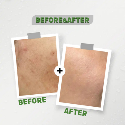 See-lit Retinol face serum